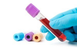 blood sample