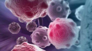 The Incredible Story of Laetrile Part I: What Causes Cancer? A Review of Popular Theories Through the Ages The Incredible Story of Laetrile Part I: What Causes Cancer? A Review of Popular Theories Through the Ages