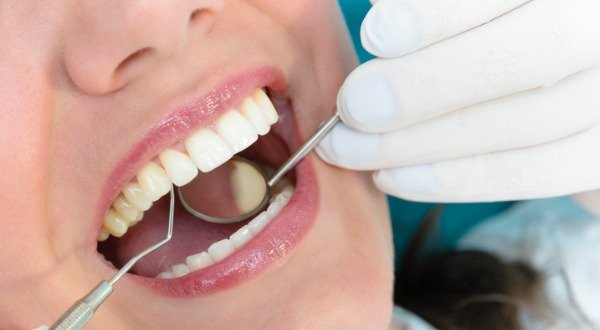 reversing tooth decay