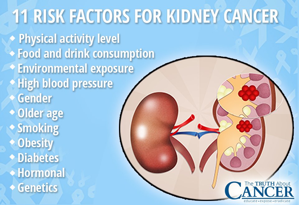 kidney-cancer-causes-11-factors-putting-you-at-risk