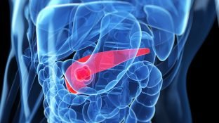 Pancreatic Enzymes: An Effective Way to Combat Cancer? Pancreatic Enzymes: An Effective Way to Combat Cancer?