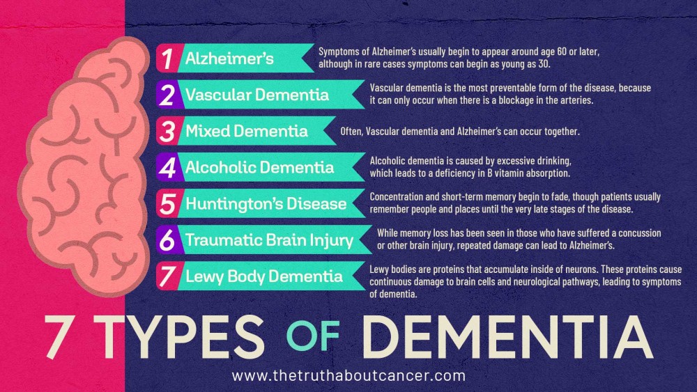 7 Stages Of Dementia Chart